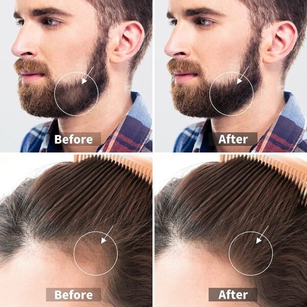 MEN DERMA ROLLER - Image 4